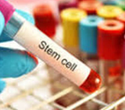 Stem Cell And Cord Blood in Mommywize