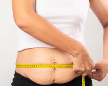 Postpartum weight loss