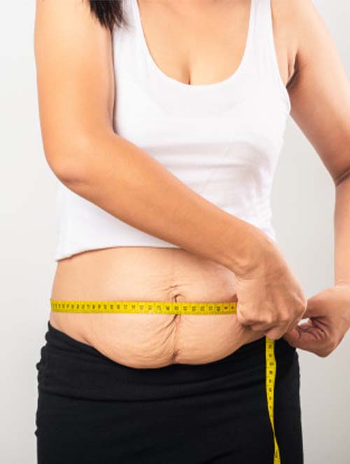 Postpartum weight loss